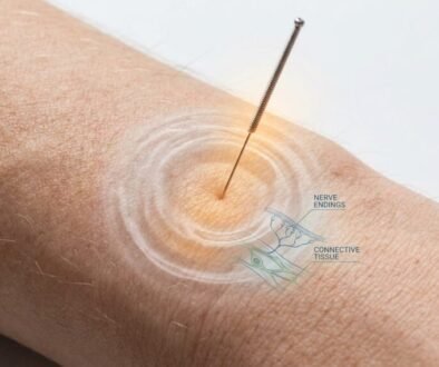how does acupuncture work