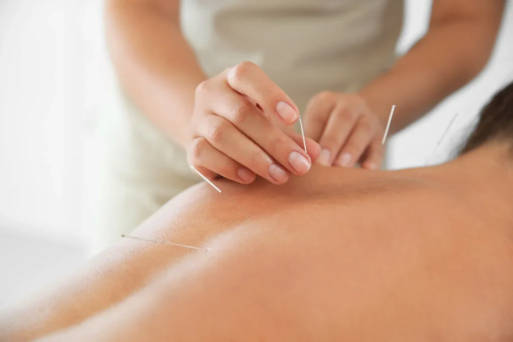 can acupuncture help with diabetes